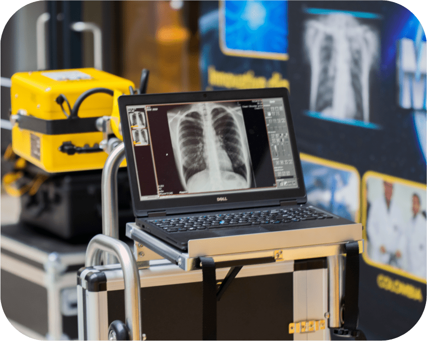Mora Mobile X Ray - contacto-03